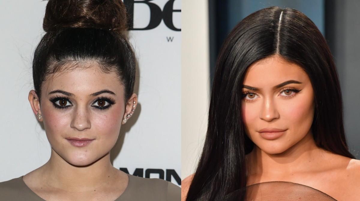 Artista muestra cómo sería actualmente el rostro de Kylie Jenner sin ninguna cirugía